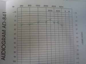 시그니아 독일보청기 오산센터 · 동탄센터 audiogram 1
