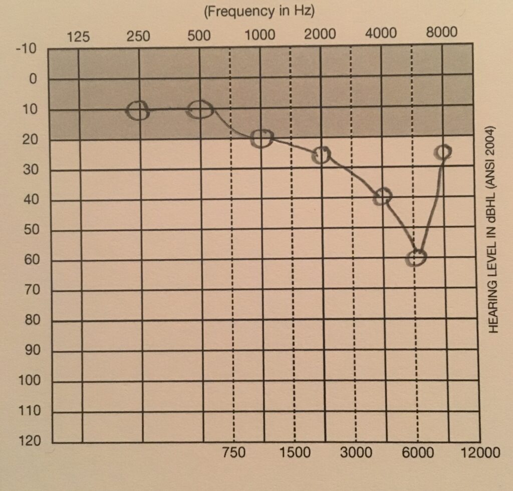 시그니아 독일보청기 오산센터 · 동탄센터 audiogram